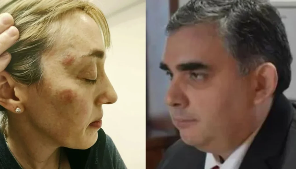 Tras cuatro años, comienza el juicio al exrelator Marcelo Guzmán por lesiones agravadas por el vínculo